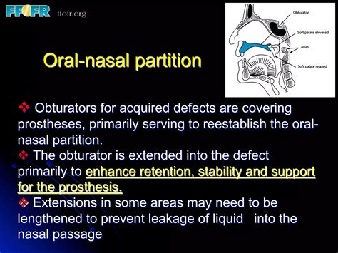 13 Definitive Obturation Treatment Concepts Ppt