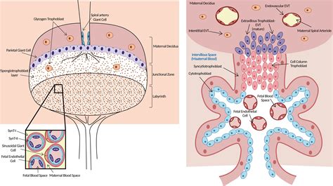 Diagramme Du Placenta Accreta