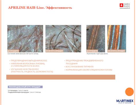 Новинка: мезококтейль для восстановления роста волос Apriline Hairline ...
