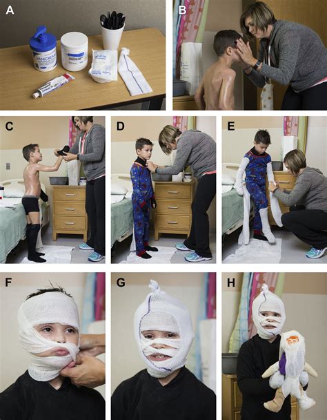 Wet Wrap Baby Eczema Face at David Greenfield blog