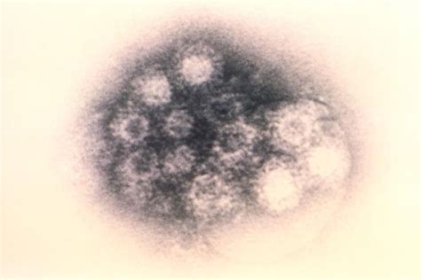 ‘Tomato flu’ outbreak in India – here’s what it really is