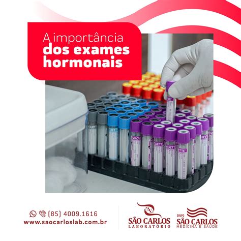 Exame De Dosagem Hormonal - O exame de dosagem hormonal é... - São Carlos Laboratório