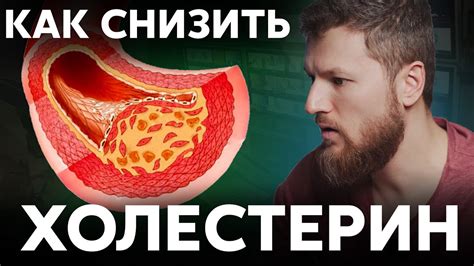 Как снизить ХОЛЕСТЕРИН, избавляемся от атеросклероза - YouTube