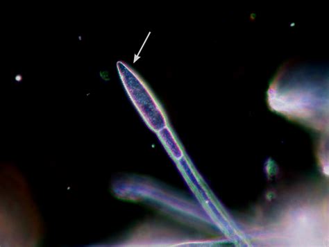Powdery Mildew On Onions Usu