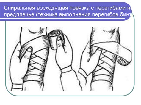 Виды повязок. Правила наложения повязок на голову, нижние и верхние ...