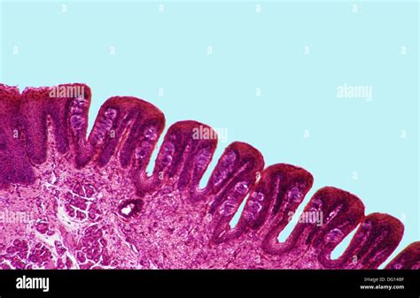 Taste Buds On Tongue Histology Kenjutaku