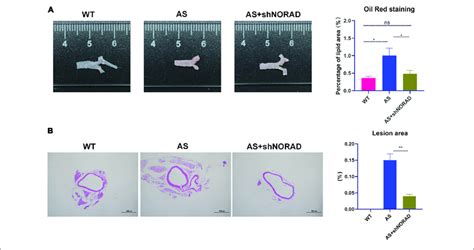 Knockdown Of Lncrna Norad Suppresses Atherosclerosis Development In