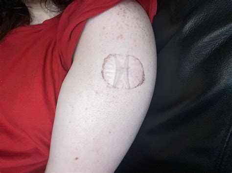Are Estrogen patches supposed to look like this? : r/trans