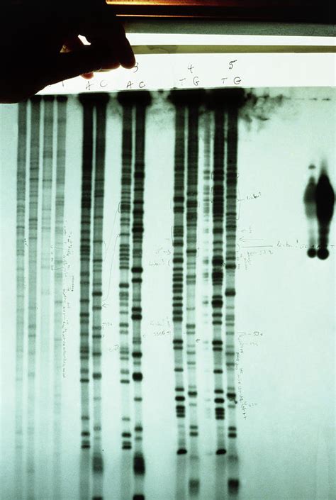 Scientist Inspecting Dna Sequencing Autoradiogram Photograph By