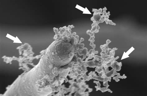 Candida Albicans