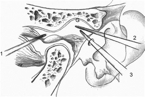 Do I need TMJ surgery - Museum Dental Center - Los Angeles