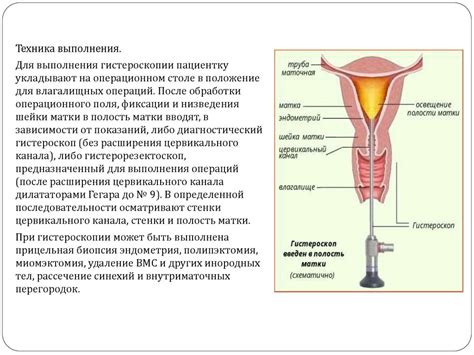 Виды и техника типичных гинекологических операций - online presentation