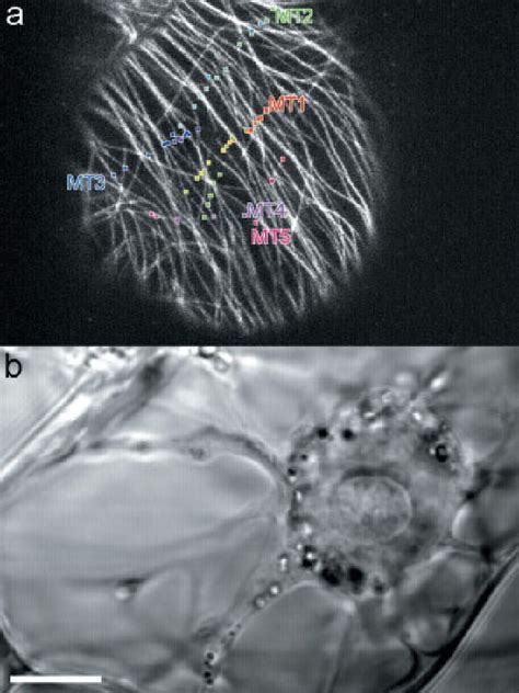 Cortical Microtubules During Interphase A Single Clsm Image From A