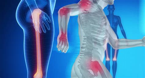 management  inflammatory myositis options  refractory disease