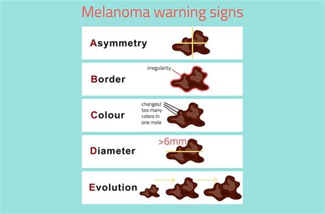 simple guide  identifying early signs  skin cancer checking
