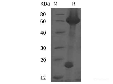 Quality Reliable Recombinant Human PCSK9 Protein His Tag PDMH100129