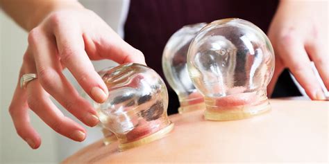 Cupping Mengenal Cupping Dan Manfaatnya Bagi Tubuh