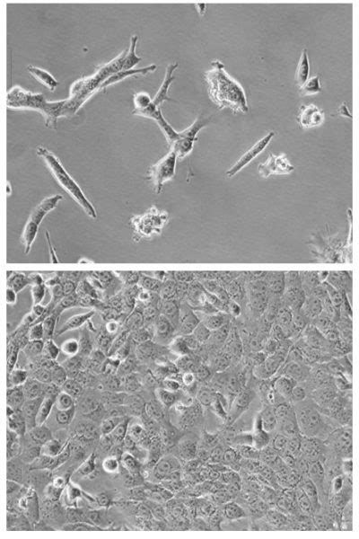 4T1 MNIS Puro Mammary Carcinoma Cell Line Imanis Life Sciences