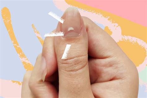 White Spots On Your Nails What They Mean And How To Get Rid Of Them Glamour Uk