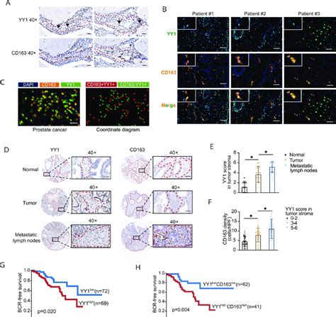 Yy1 Was Positively Correlated With Cd163 M2 Macrophages In Human Download Scientific Diagram