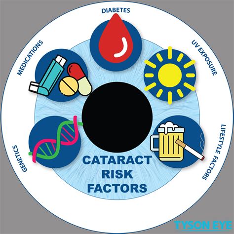 Does Everyone Eventually Get Cataracts? - Tyson Eye | Cataracts | Risks