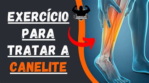 Exercício para tratar CANELITE em casa ou na academia Canal do