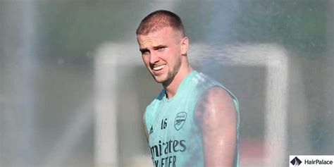 Rob Holding Hair Transplant Cost And Results