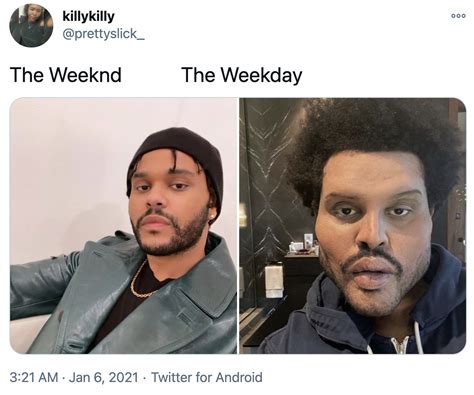 The Weeknd Reconstructive Surgery / A selfie of the weeknd in those prosthetics inspired a ...