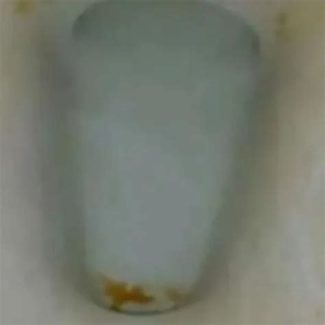 Potato Gay Bdsm Bdsm Porn Xhamster