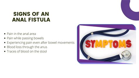 Know More About Anal Fistula PPT