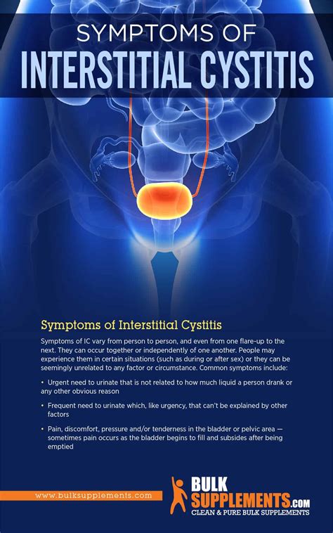 Interstitial Cystitis: Symptoms, Causes & Treatment