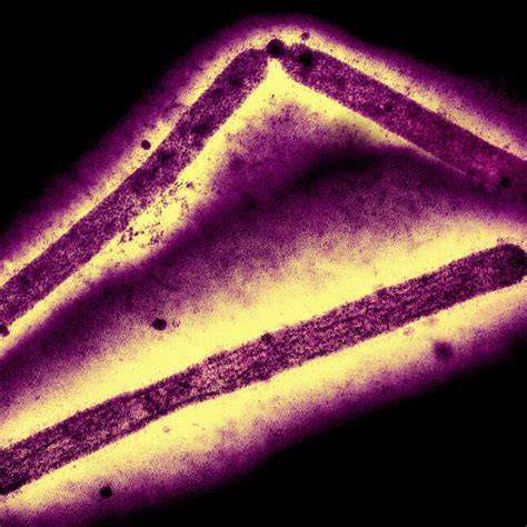 Cdcs Top Flu Scientist Says The Risk To The Public From H5n1 Is Low