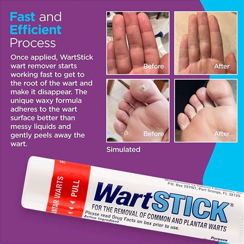 Wartstick Maximum Strength Salicylic Acid Solid Stick Wart Remover 02 Oz
