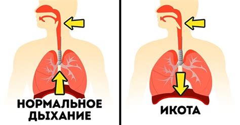 Как избавиться от икоты: masterok — LiveJournal