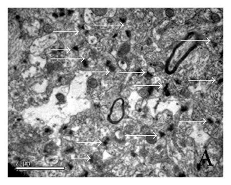 Ultrastructural changes of hippocampus and neurons by TEM and SEM ...