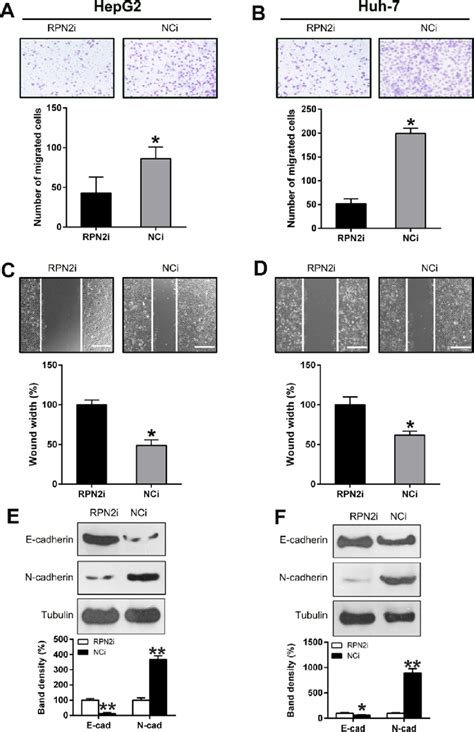 Silencing Of Rpn Suppressed Hcc Cell Migration And Invasion After