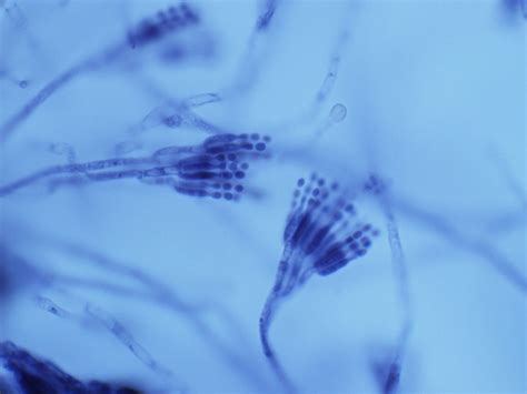 Penicillium 100x 1v