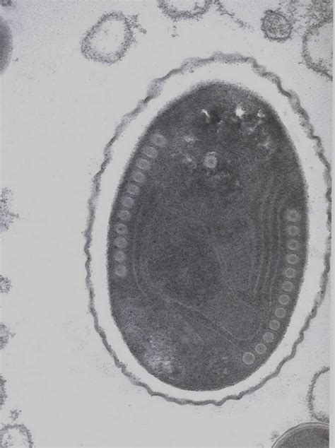 Electron Micrographs Of Mature Spores Panel A Mature Spore With Thin