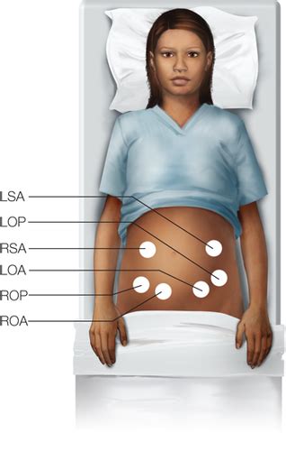 Intrapartum Care Test Flashcards Quizlet