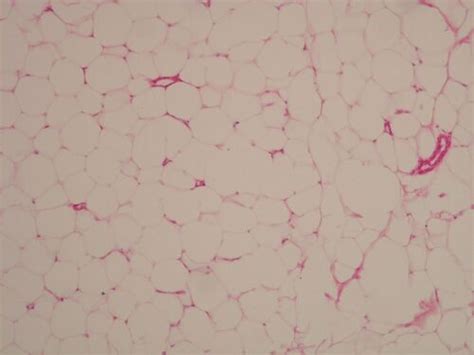 Adipose tissue (histology slide) - WikiLectures