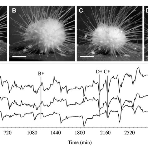 contraction pattern  main contraction states   fused