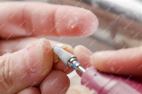 Técnico Dental Haciendo Dentaduras Parciales De Resinas Acrílicas
