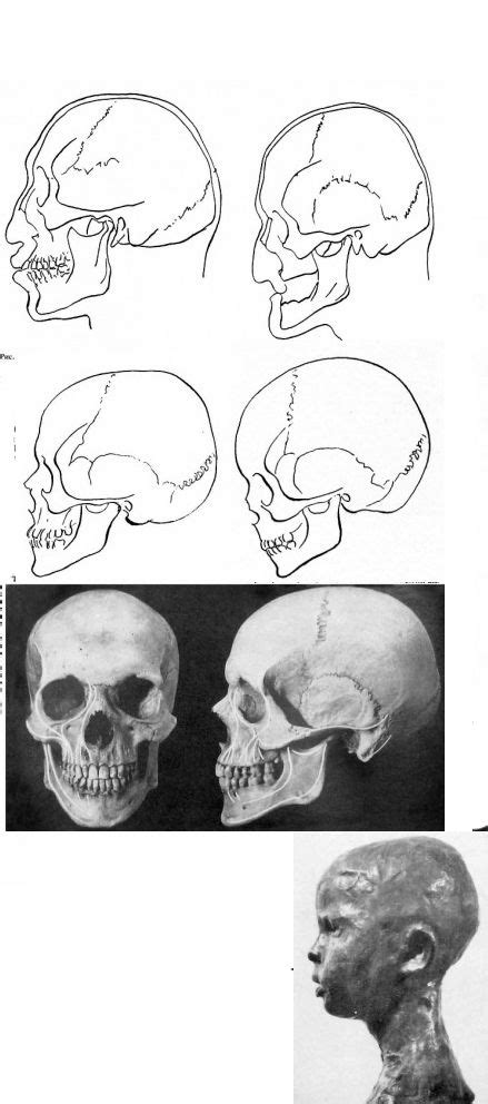 Plates from the book Traité complet de l anatomie de l homme Arte