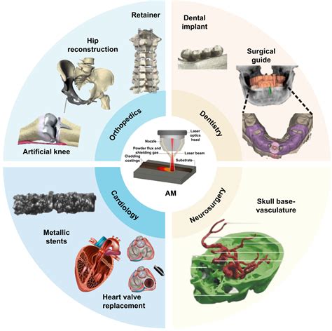 Revolutionizing medical implant fabrication: advances in additive