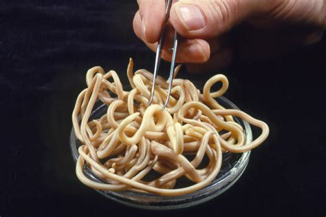 Parasitic Nematode Worms Photograph by Sinclair Stammers - Pixels