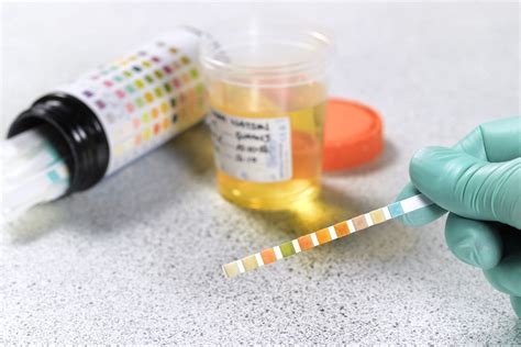 Urine Drug Test Things You Must Know To Pass A Drug Screening Test