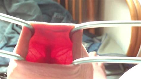 Foreskin In Sunlight Gay Amateur Amateur Porn XHamster