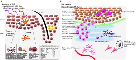 Frontiers Current Insights In Cutaneous Lupus Erythematosus