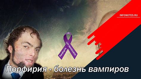 Порфирия - болезнь вампиров - YouTube