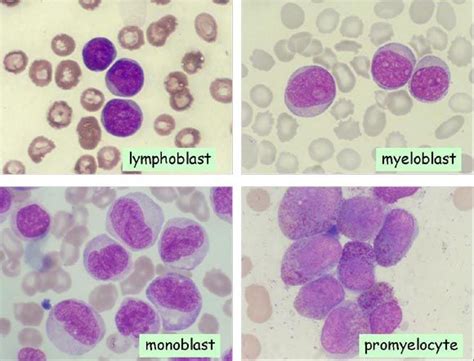types  blasts cells medicine notes vet medicine science lab